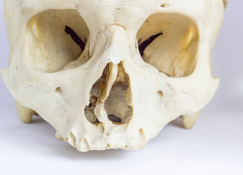 close up macro view of human skull bone showing the anatomy of nasal foramen, nasal septum and orbital cavity