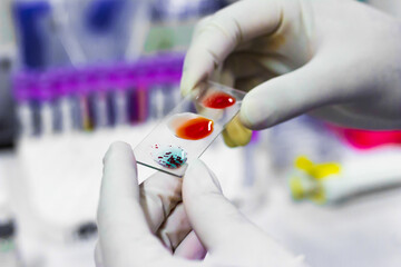 blood grouping on glass slide showing A+ group