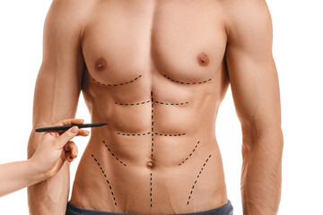 Plastic surgeon applying marking on man's body against white background