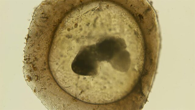 Movement of an embryo in the egg casule of the snail Gastropoda under a microscope, of the family Baicaliidae, a sample found on Lake Baikal. Shirokaya Alena helped to identify