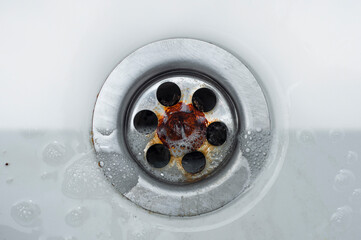 Dirt in the kitchen sink that cannot be washed, ingrained dirt