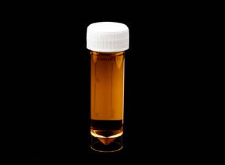 Urine sample in a plastic specimen container, isolated on a black background.
