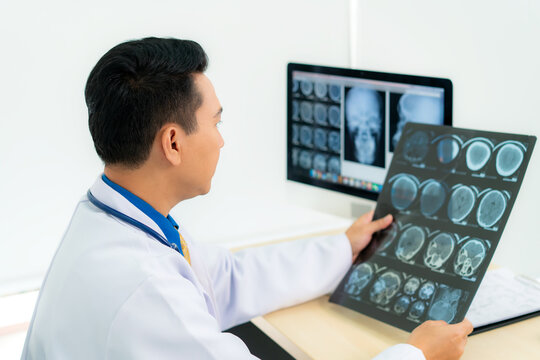 Asian Man Doctor Holding And Looking To Examining X Ray Of The Patient’s Skull And Brain In A Medical Clinic At Hospital.