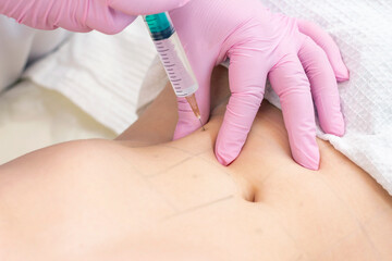 lipolytic injections are placed in the stomach. female hands in pink gloves inject a young woman into the stomach.