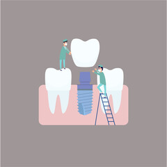 Two dentists perform dental implantation: install the implant on the abutment. Vector illustration, in a flat style. Poster to the clinic, image for instructions for dentists, training books