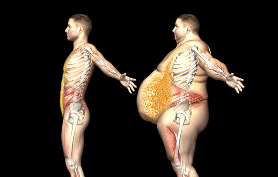Visceral Fat" Images – Browse 111,189 Stock Photos, Vectors, and Video |  Adobe Stock
