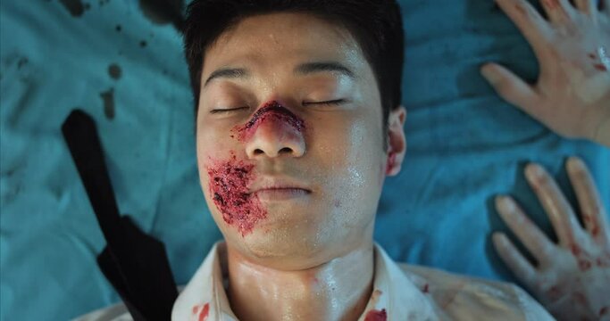Close up of asian guy with head injuries lying on medical stratcher in ambulance. Young man with wound and blood on his head losing consciousness while riding to hospital after accident
