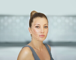 thread lift procedure ,non-surgical facelift,markup