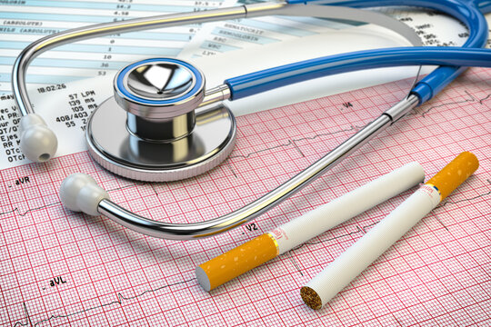 Stop smoking concept. Stethoscope, cigarettes and electrocardiogram report. Heart problem due to smoking.