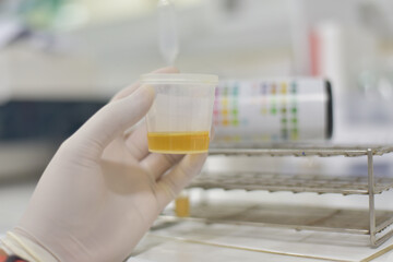 Medical report and urine test strips.