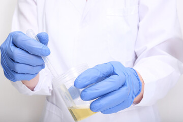 A doctor, lab technician in blue gloves holding urine sample in a plastic container, urinalysis and filling the pipette with urine for testing, medical check-up concept