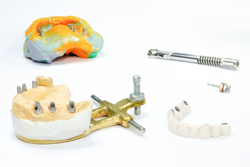 jaw model with dental implants and ceramic crowns. in the background is a dental impression with implantation tools. the process of manufacturing dental crowns on implants