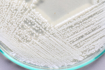 Yeast in petri dish, Microbiology for education in laboratories.
