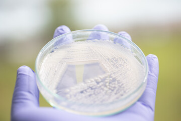 Yeast in petri dish, Microbiology for education in laboratories.
