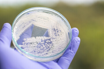 Yeast in petri dish, Microbiology for education in laboratories.
