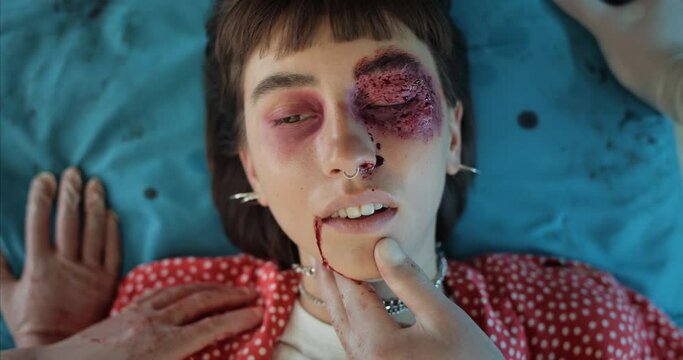 Close up view of young hipster girl with blood and head traumas losing consciousness. Millennial woman with serious injuries lying on hospital stretcher while going in ambulance