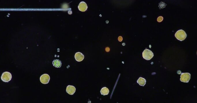 Glenodinium sp.under the microscope for education.
