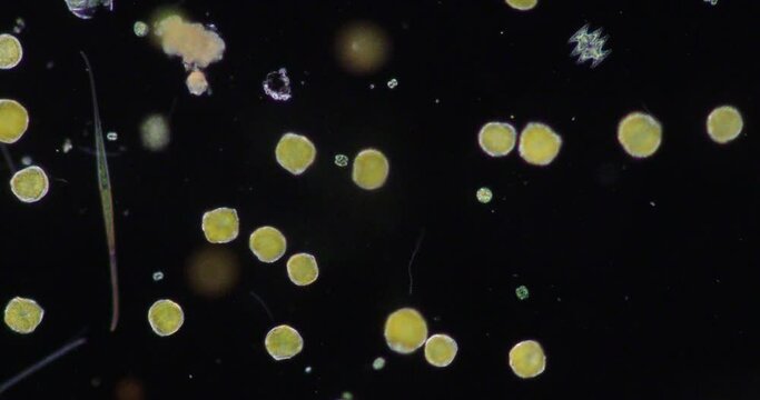 Glenodinium sp.under the microscope for education.
