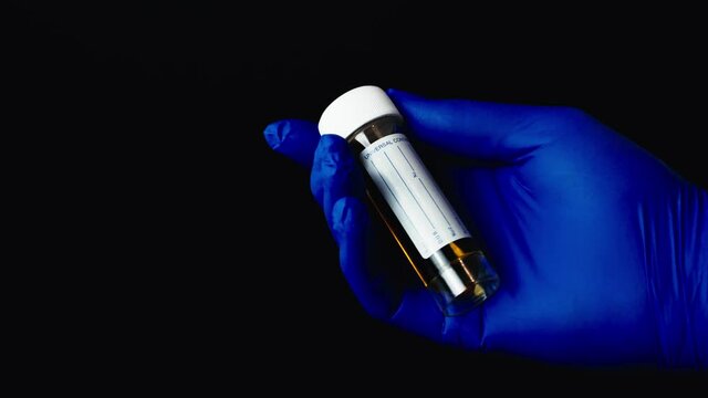 Doctors or nurses hand in a blue medical glove, handles a urine sample in a specimen container. Isolated on black background.