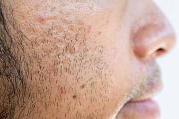 Side view of facial hair grown on men's cheek. Facial hair is hair grown on the face.