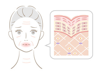 しわ　肌の断面図　女性