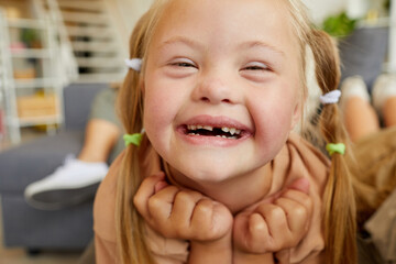 Close up portrait of blonde girl with down syndrome smiling happily looking at camera while lying...
