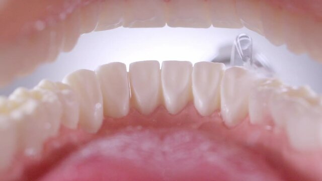 Water flosser cleaning teeth on white background. View inside of mouth, open jaw. Teeth cleaning with oral irrigator. Full HD 240 fps