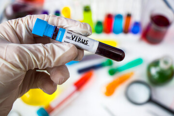 virus blood test tube in laboratory, glassware and reagents