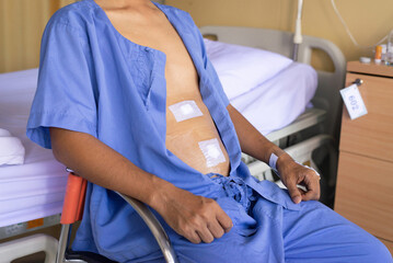 Obraz premium Patient man showing sticking plaster patched surgery wound on stomach after surgical