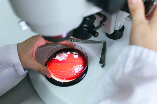 Biologist Working with Bacterial Culture in the Laboratory