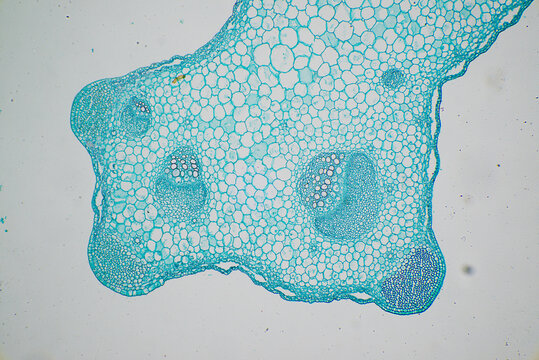 Stem Collenchyma plant cells