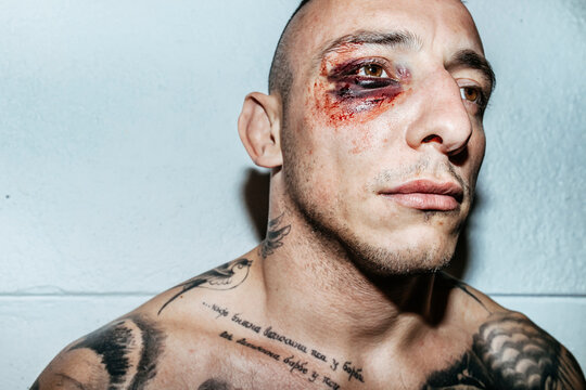 injuries, eye bruise, fight, fighter, tattoo, attitude,