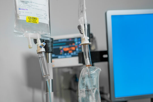 IV Infusion of Chemo Cancer Treatment