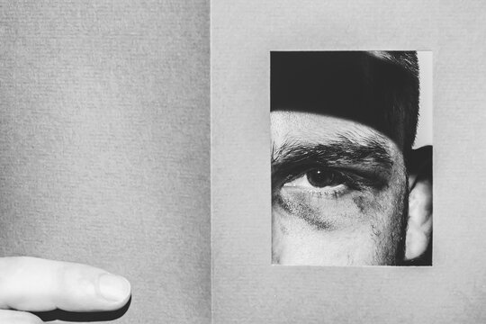 eye,bruising,hide,beard