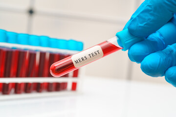 Blood sample   test tube in doctor hand for  Blood Test with MERS-CoV test
