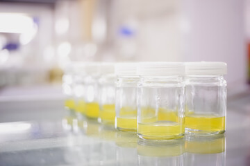 The glass bottles containing solid media for plant tissues culture on the shelf in the  laboratory.