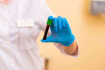 Test tube with blood in assistant`s hand. Blood laboratory. Illness testing. Emergency testing. Virus infection.