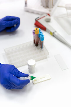 Helicobacter pylori rapid test performed in a lab