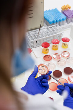 Lab technician putting a sample on an agar plate for testing