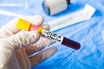 Fototapeta premium Corona virus negative test samples. Diagnosis and laboratory. Studio shoot, white background.