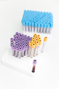 Blood sample in the tube on top of a white table in a laboratory