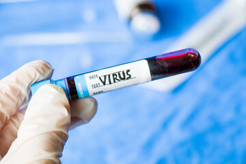 Obraz premium virus blood test tube in laboratory, glassware and reagents