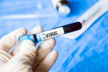 Obraz premium virus blood test tube in laboratory, glassware and reagents