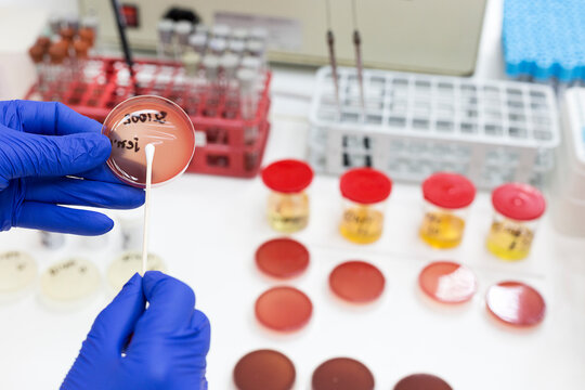 Lab technician putting a sample on an agar plate for testing