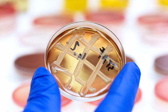 Hand in the glove holding Staphylococcus colony on a petri dish in the laboratory