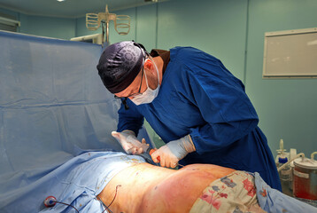 Team surgeon at work in operating room.
