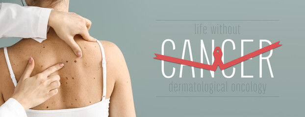 Dermatologist examining moles of patient on grey background. Concept of skin cancer