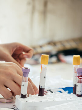 medical blood test tubes