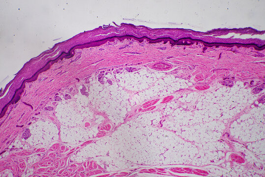 Sweat gland in human skin