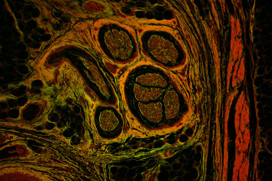 Sweat gland in human skin